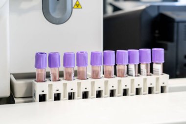 Laboratuvar aşı için testler yapıyor. Kan koleksiyonu ve hematoloji analizleri.