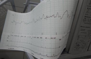 Sabitleme ve kalp hızı grafikleri yazdırma Sevgiliye