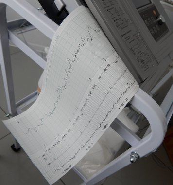 Sabitleme ve kalp hızı grafikleri yazdırma Sevgiliye