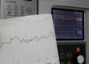 Sabitleme ve kalp hızı grafikleri yazdırma Sevgiliye