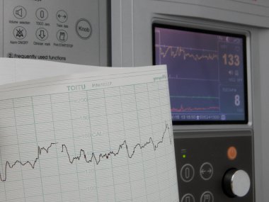 Sabitleme ve kalp hızı grafikleri yazdırma Sevgiliye