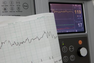 Sabitleme ve kalp hızı grafikleri yazdırma Sevgiliye