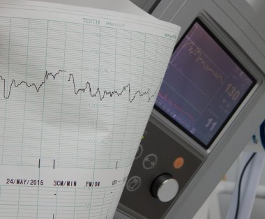 Sabitleme ve kalp hızı grafikleri yazdırma Sevgiliye