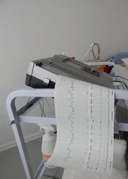 Cardiograph 고정 하 고 심장 박동의 그래프 인쇄 — 스톡 사진