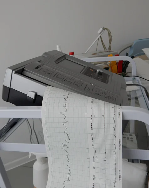 Cardiograph για τον καθορισμό και την εκτύπωση γραφήματα της καρδιακής συχνότητας — Φωτογραφία Αρχείου