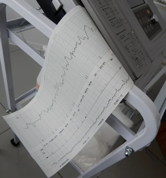 Fijación del cardiógrafo e impresión de gráficos de frecuencia cardíaca —  Fotos de Stock