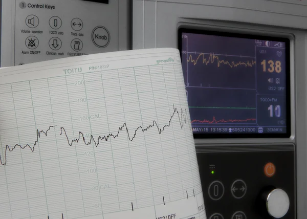 Sabitleme ve kalp hızı grafikleri yazdırma Sevgiliye