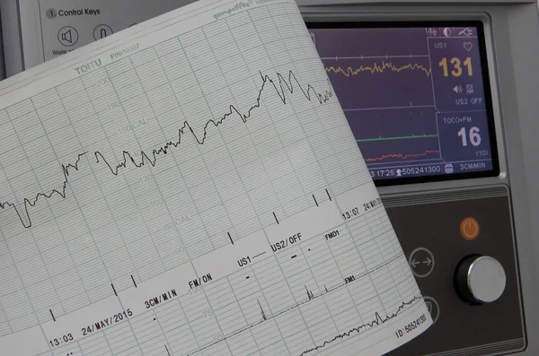 Sabitleme ve kalp hızı grafikleri yazdırma Sevgiliye