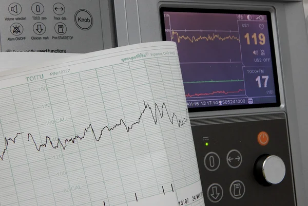 Кардіографія фіксує і друкує графіки частоти серцевих скорочень — стокове фото
