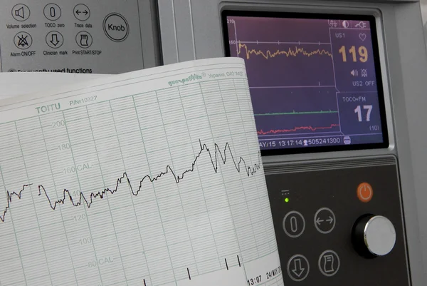 Cardiograph 고정 하 고 심장 박동의 그래프 인쇄 — 스톡 사진