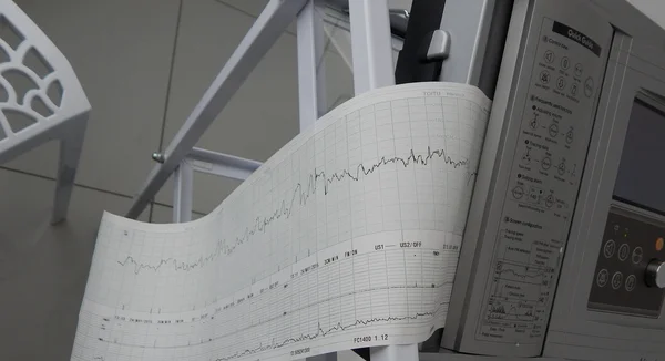 Cardiograph fixing and printing graphs of heart rate — Stock Photo, Image