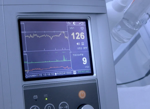 Cardiograph fixing and printing graphs of heart rate — Stock Photo, Image