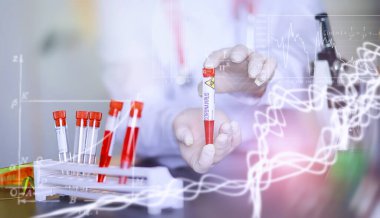 Laboratuvardaki bir bilim adamı viral zatürreenin tedavisi için ilaçları test ediyor. Hastalıklı hastaların Coronovirus kan testi. Dünya salgını.