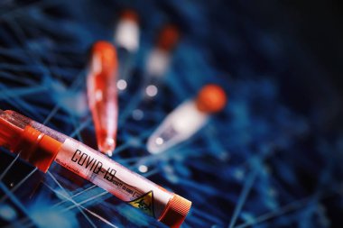 Test tüpü ve hasta kan testi. Virüs analizi. Coronavirus salgını laboratuvar çalışmaları. Aşı geliştirme.