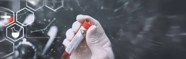 몸에서 바이러스인 코로나 바이러스를 검사하기 샘플이야 코로나 바이러스 검사가 시험관 — 스톡 사진