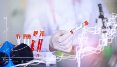 Laboratuvardaki bir bilim adamı viral zatürreenin tedavisi için ilaçları test ediyor. Hastalıklı hastaların Coronovirus kan testi. Dünya salgını.