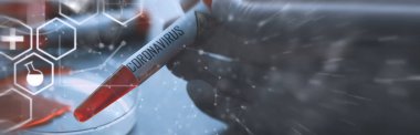 Vücudundaki tehlikeli virüs koronavirüsünü test etmek için bir kan örneği. Coronavirus testi yapılan tüpler. Virüs hastalıklarının laboratuvar çalışmaları.