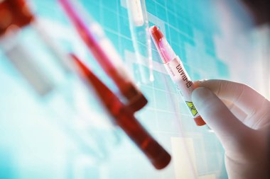 Test tüpü ve hasta kan testi. Virüs analizi. Coronavirus salgını laboratuvar çalışmaları. Aşı geliştirme.