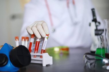 Laboratuvardaki bir bilim adamı viral zatürreenin tedavisi için ilaçları test ediyor. Hastalıklı hastaların Coronovirus kan testi. Dünya salgını.