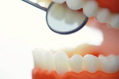 Dişçinin ofisi. Dişçi ağız boşluğu tedavisini inceliyor. Doktor bir tedavi yöntemi gösteriyor. Tedavi görüyor. Kaplamaların yerleştirilmesi ve yerleştirilmesi.