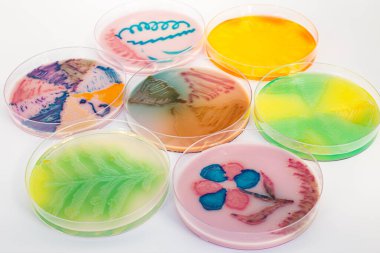 Petri kabında farklı bakteriler gelişiyor.