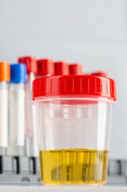 Biyolojik idrar testi için laboratuvar bardağı. Kan testi tüplerinin yanında kapalı kapaklı.