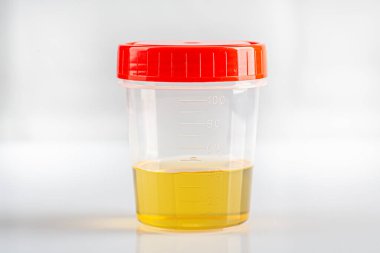 Biyolojik idrar testi için kapalı kapaklı laboratuvar bardağı.