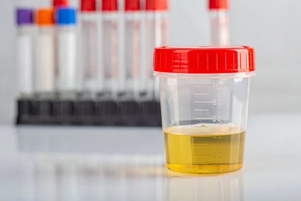 Biyolojik idrar testi için laboratuvar bardağı. Kan testi tüplerinin yanında kapalı kapaklı.
