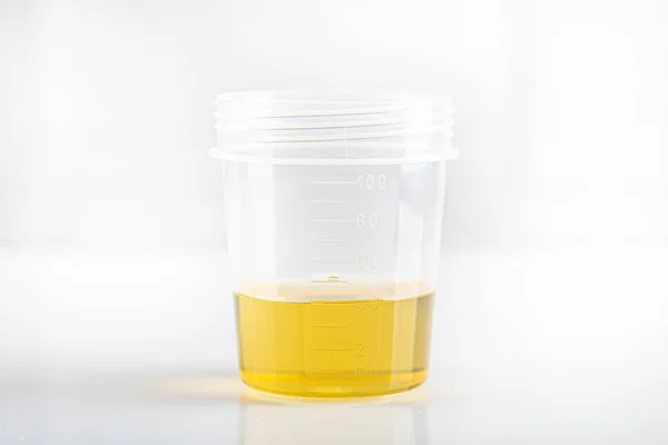 Laboratory cup for the biological urine test