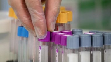 Boş Plastik şişeleri durumda koyarak