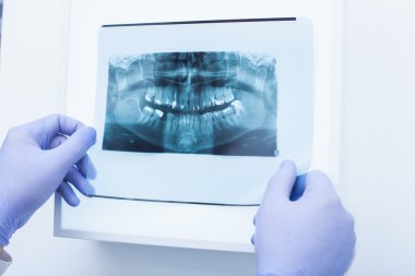 Erkek doktor diş röntgen arıyorsunuz