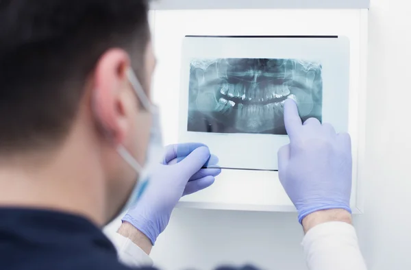 Доктор смотрит на рентген зубов — стоковое фото