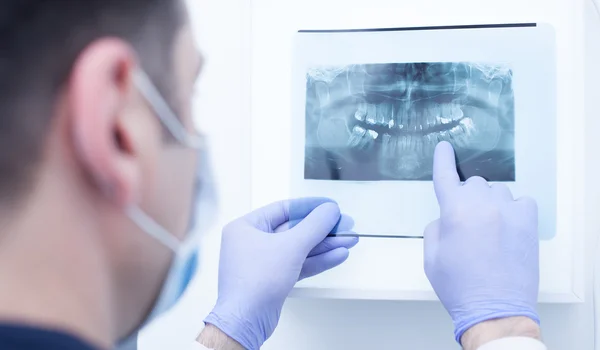 Médico varón mirando rayos X dentales — Foto de Stock