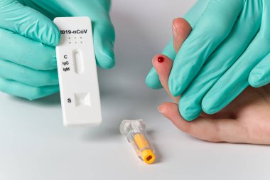 Yeni Corona virüsü enfeksiyonu teşhisi için pozitif COVID-19 testi ve laboratuvar örneği