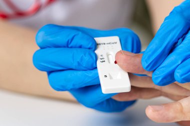 Yeni Corona virüsü enfeksiyonu teşhisi için COVID-19 test ve laboratuvar örneği.