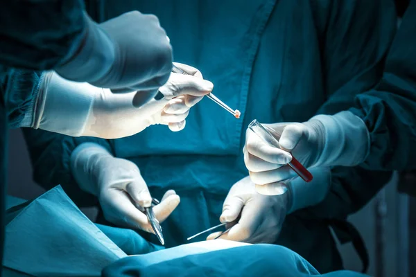 Yoğunlaşmış profesyonel cerrahi doktor ekibi hastanenin ameliyathanesinde bir hastayı ameliyat ediyor. Tümör kanseri. Cerrahi biyopsi örnekleri. Sağlık ve Tıp Konsepti