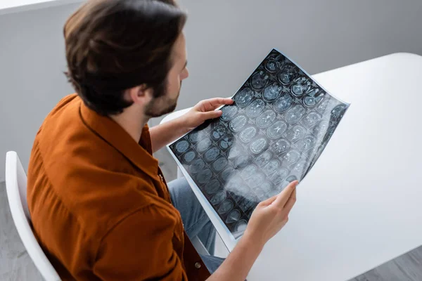 Uomo Offuscata Guardando Risonanza Magnetica Mentre Seduto Tavola — Foto Stock