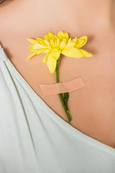 Cropped view of plaster with yellow flower on body of woman — Stock Photo