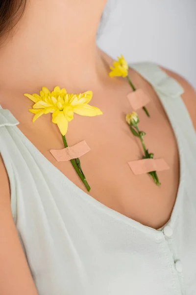 Cropped view of plasters with yellow flowers on body of woman isolated on white — Stock Photo