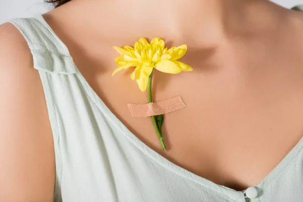 Обрезанный вид на желтый цветок с гипсом на теле молодой женщины — стоковое фото