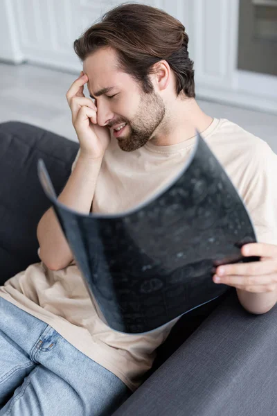 Vista lateral del hombre que sufre de dolor de cabeza mientras sostiene la resonancia magnética - foto de stock