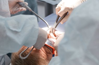 Diş hekimleri, doktorlar diş cerrahisi yapar, diş implantları ameliyathanede.