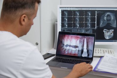 Dişçi, doktor bilgisayara bakar, monitördeki takma dişleri gösterir, anteriorların yakın plan resmini gösterir.