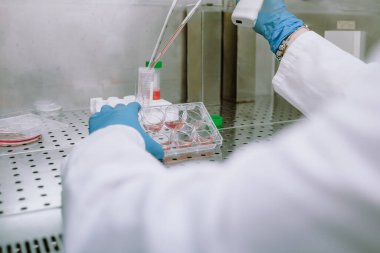 İtalya - 14 Şubat 2024: Steril kaput altında bilimsel laboratuvar analizi kapsamında biyolojik deney yapan koruyucu ekipman araştırmacısı.