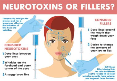 Neurotoxins or fillers. Infographics. Neurotoxin injection. Woman facial wrinkle treatment. Infographics of medical cosmetic procedures for face skin. Botox. Vector Illustration clipart