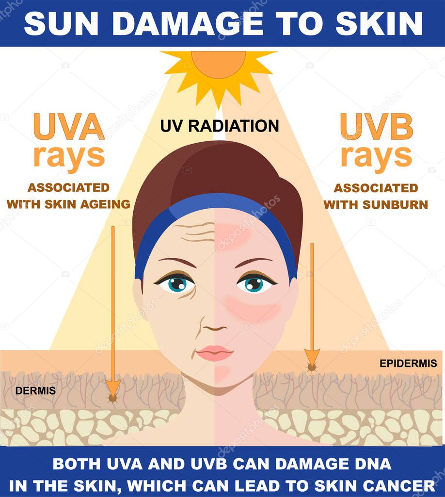 Sun damage to skin.The difference of radiation 2 types in sunlight which is harmful to the skin. Infographic of difference between UVA and UVB rays. UV penetration into human skin and woman face.