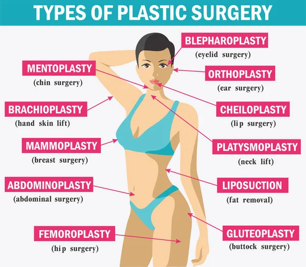 Médecine Chirurgie plastique infographies. Types de chirurgie plastique. Infographies sur la chirurgie plastique du corps et du visage pour affiches et brochures. Éléments vectoriels et icônes — Image vectorielle