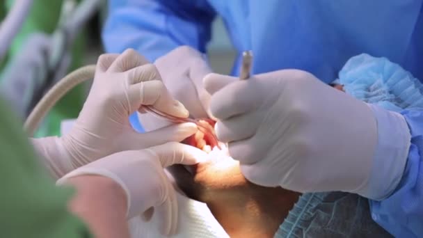 医療用手袋の歯科医歯科クリニックで患者と仕事をしています ヘルスケアと医療の概念 — ストック動画