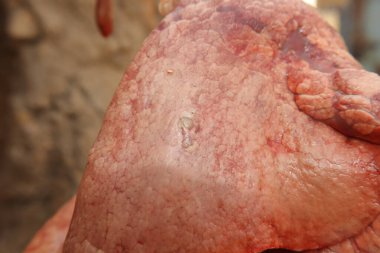 Echinococcus granulosus 'un sebep olduğu koyun ciğerindeki hidatid kist. Önemli veteriner, halk sağlığı vakası zoonotik enfeksiyonu vurguluyor, et denetimi, gıda güvenliği riskleri, hayvan hastalıkları farkındalığı.