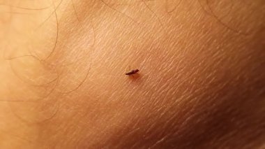 İnsan derisindeki pireler hayvan üstüne hayvan derisinden insan derisine sıçrıyorlar. Tıbbi, veterinerlik, sağlık eğitimi ve belgesel kullanımı için zoonotik risk ve mesleki teşhirciliği vurguluyor